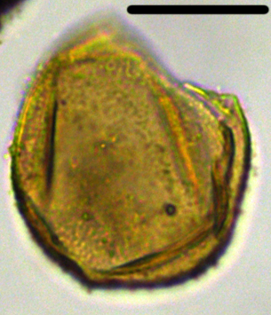 Pyxidinopsis iakovlevae Xensp27X3110112220990b.jpg